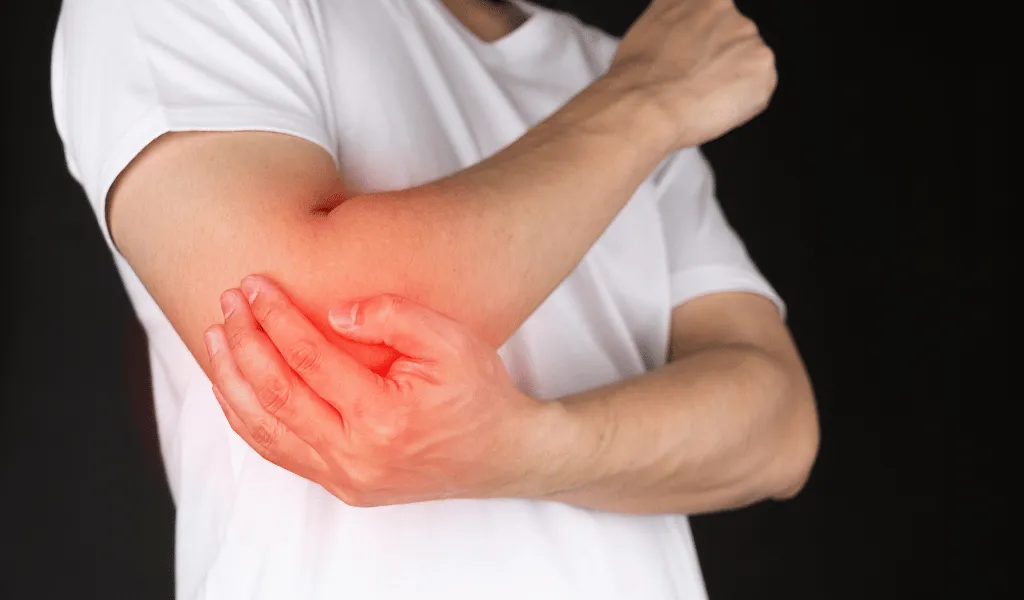 Bursitis
